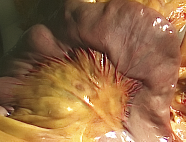 Foto: Dünndarm mit Aufhängung (Mesenterium) und Blutgefäßen.