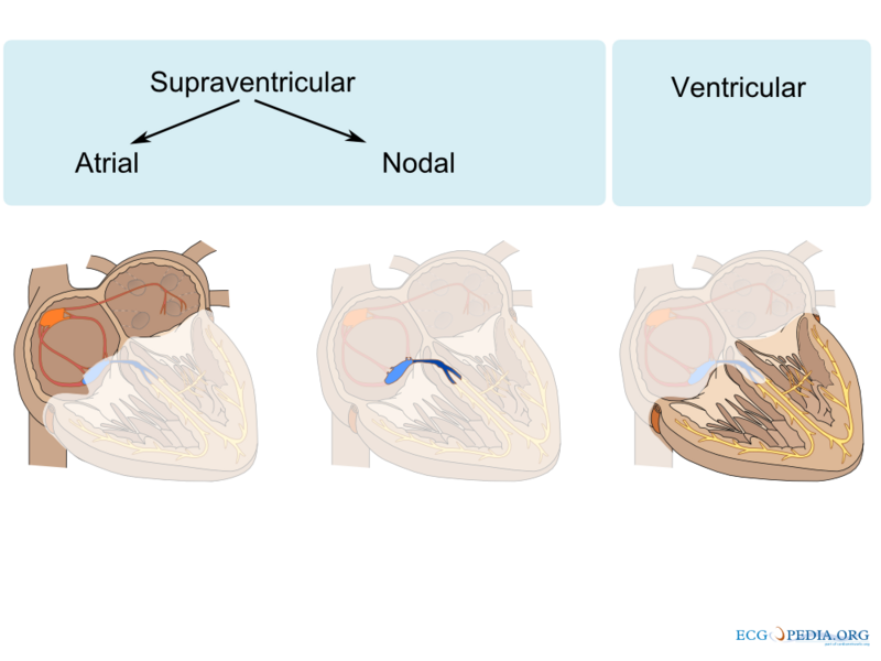 ../../_images/De-Atrial_ventricular_CardioNetworks_ECGpedia.png