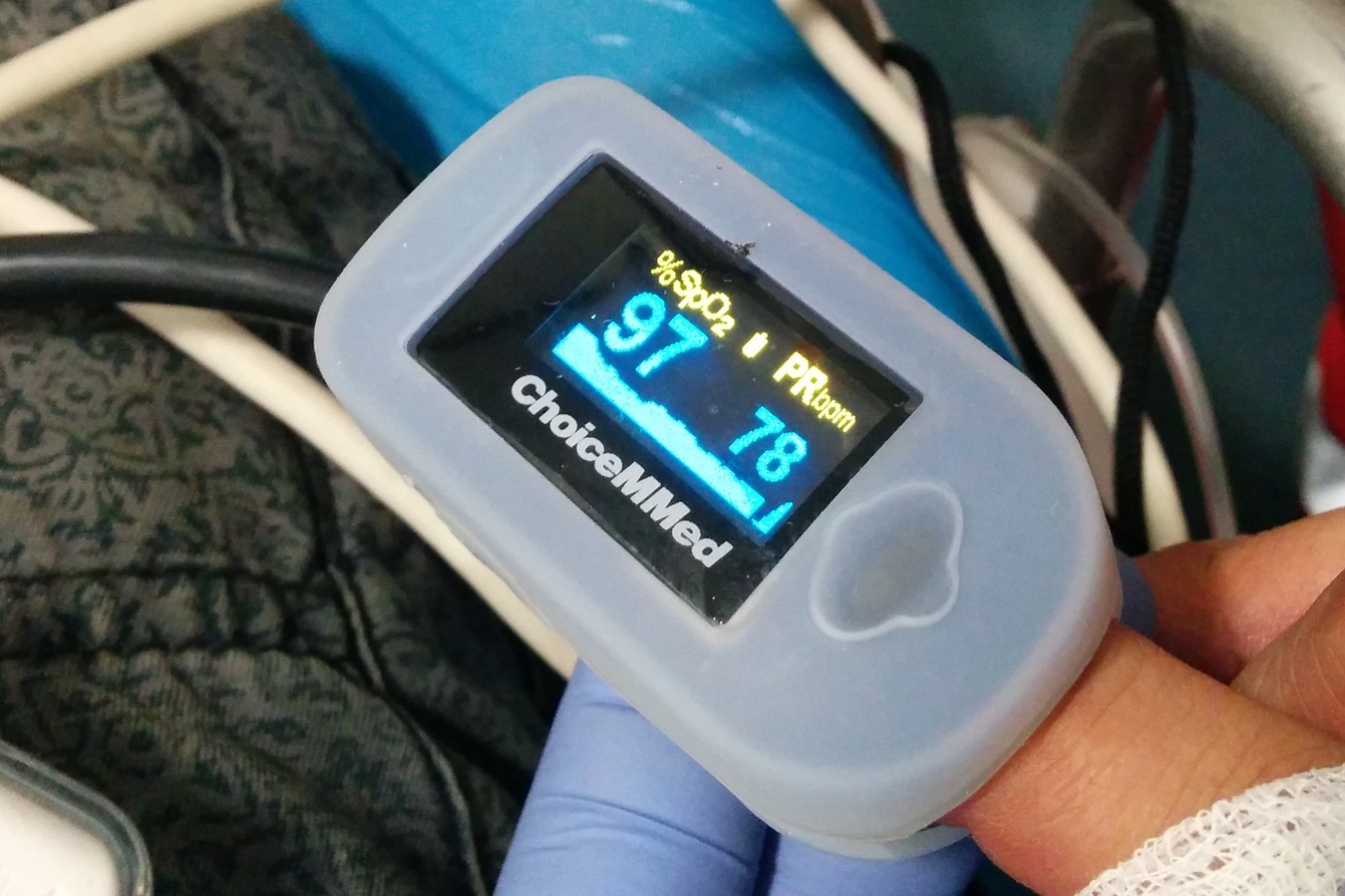 Ein Finger-Pulsoxymeter; © Sebastian Gabriel, ℓ MfG