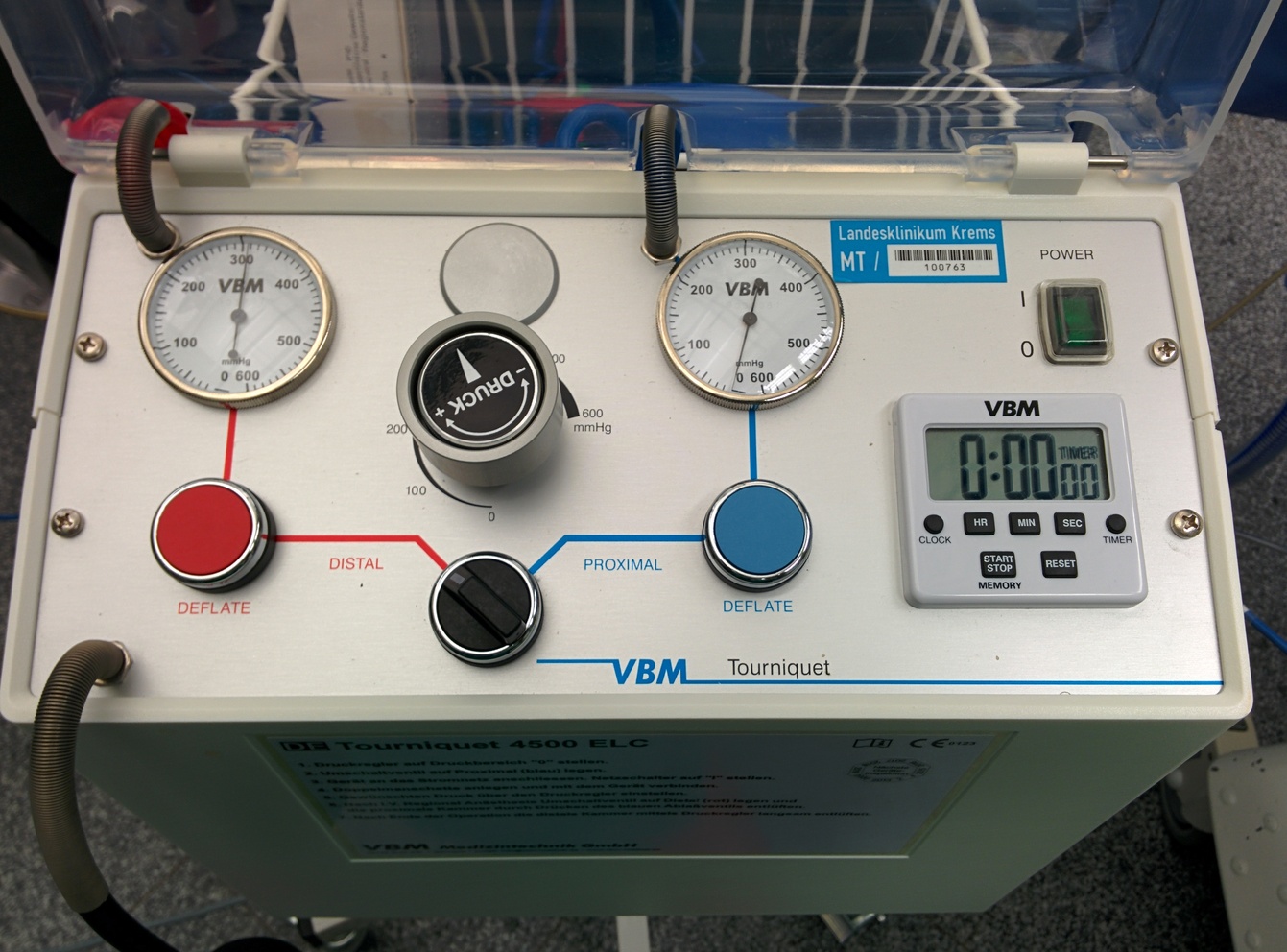 Doppelte Blutsperre für Bier-Block