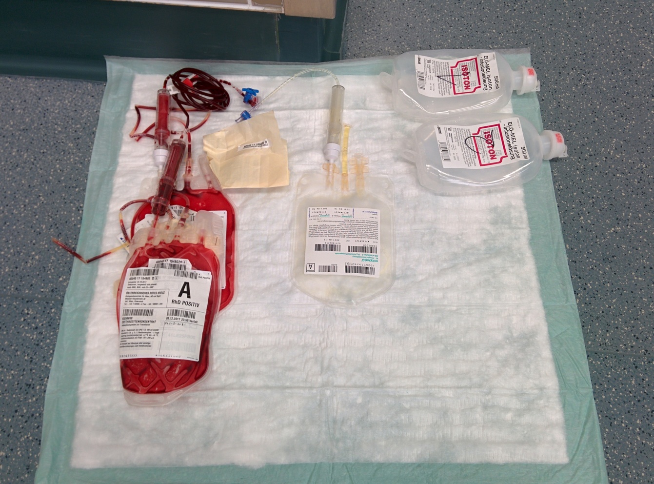 Die ersten Erythrozytenkonzentrate, FFPs, balancierte Kristalloide Infusionslösungen, ...