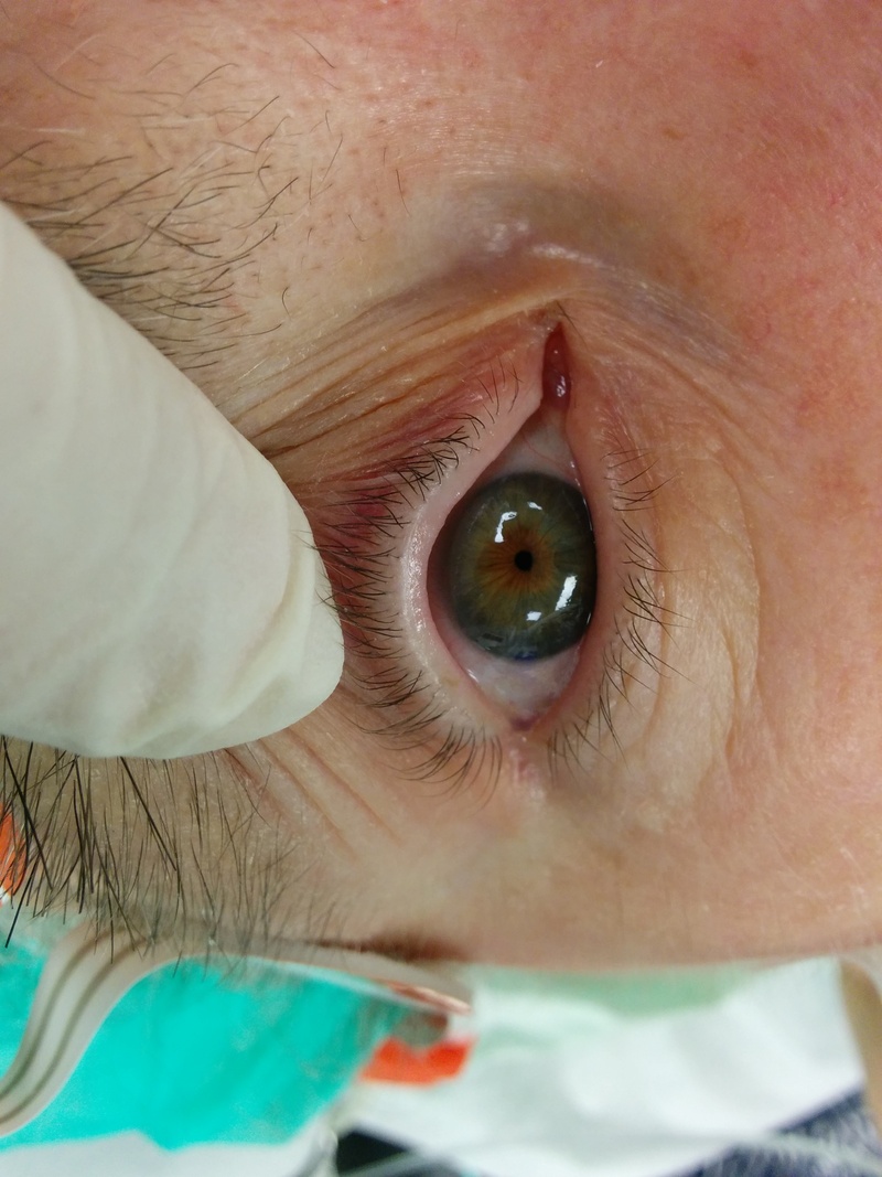 Enge Pupille © Sebastian Gabriel, 