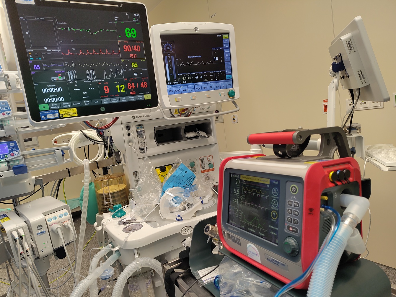 Auch das ist möglich: Ein Patient in Spinalanästhesie mit respiratorischer Insuffizienz wird im OP mittels eines Transportrespirators (Hamilton T1) nicht-invasiv beatmet (CPAP+PSV).