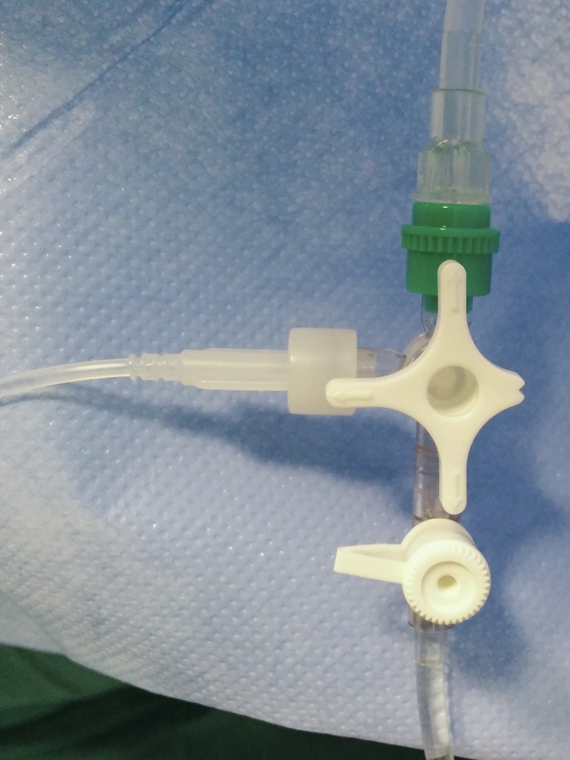 Mittels eines 3-Weg-Hahns können weitere Infusionen angeschlossen werden.