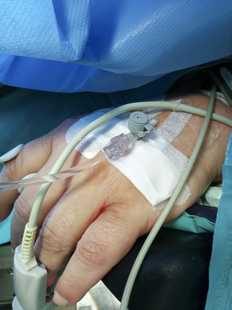 Schlussendlich wird die Infusion an einem Zugang zum Patienten angeschlossen, hier an einer peripheren Venenverweilkanüle.