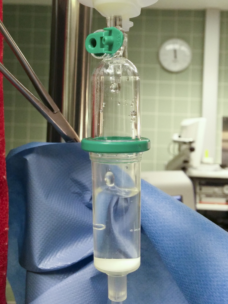 Der Dorn des Infusionsbestecks mit der Tropfkammer wird an der Infusionsflasche oder -beutel befestigt, die Tropfkammer ca. bis zur Hälfte gefüllt.