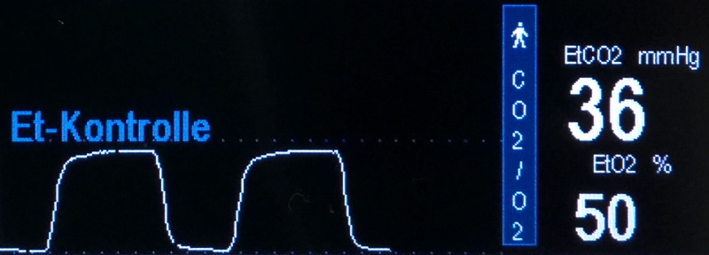 Die Kapnometrie ist wichtig, um die korrekte Lage des Tubus in der Luftröhre zu bestätigen.